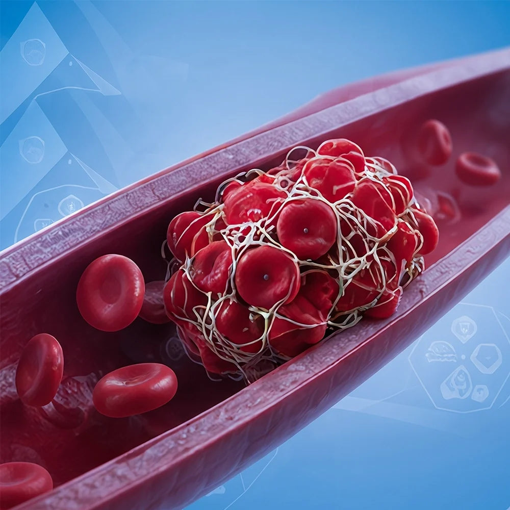 Blood Clotting Disorders